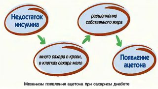 ацетон при сахарном диабете