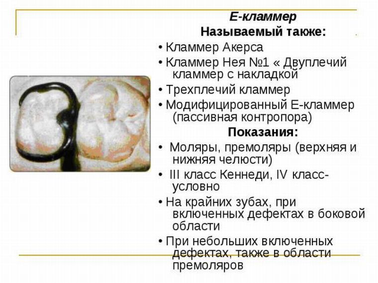 кламмер Акерса