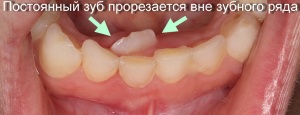 акульи зубы