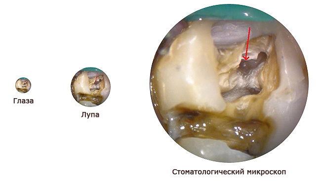Увеличение под микроскопом