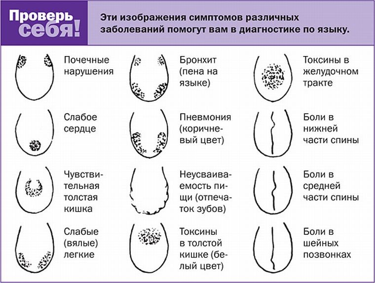 Заболевания по языке