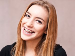 аллергия на брекеты