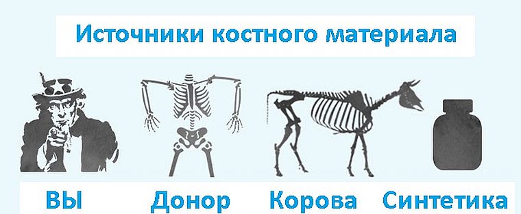 источники костного материала