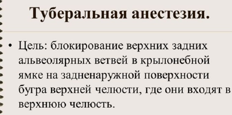 туберальная анестезия