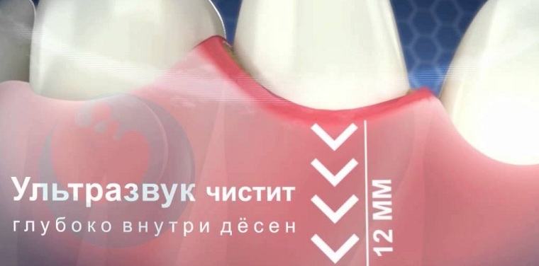 Принцип действия УЗ устройства