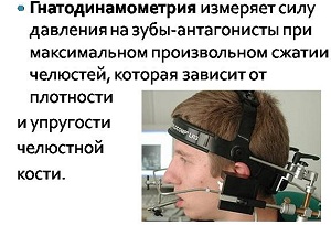 гнатодинамометрия
