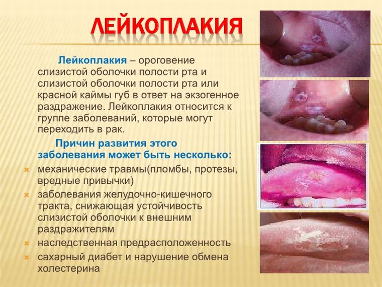 Признаки и причины