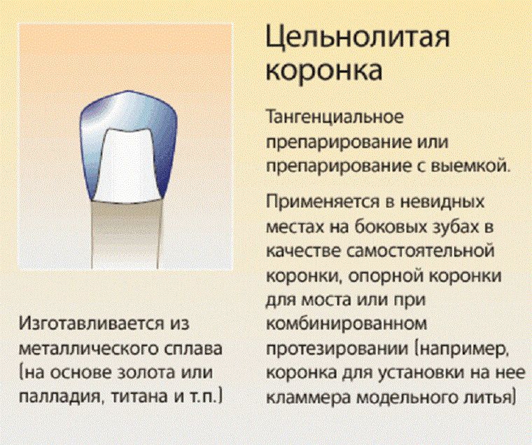 цельнолитая коронка