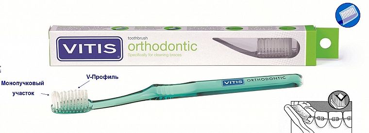 Vitis Orthodontic