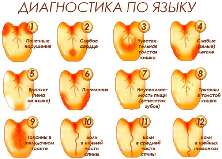 Диагностика болезней по языку