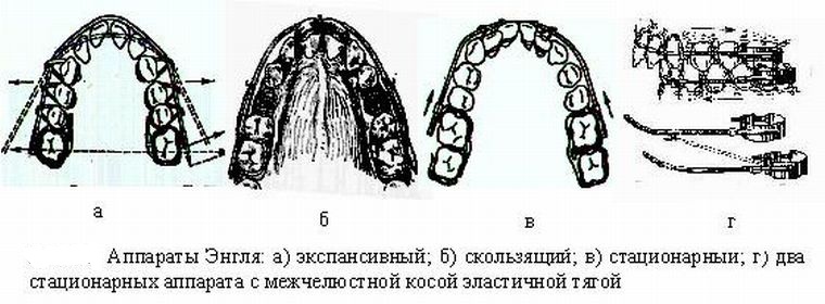Конструкция Энгля