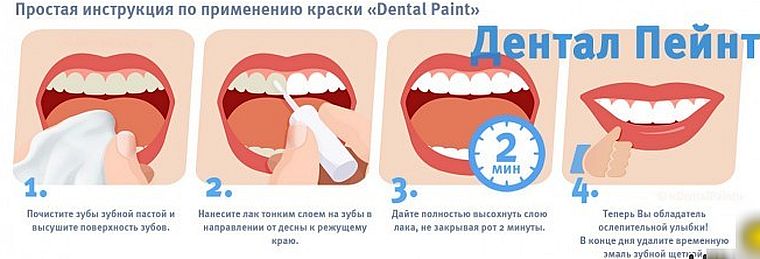 Dental paint