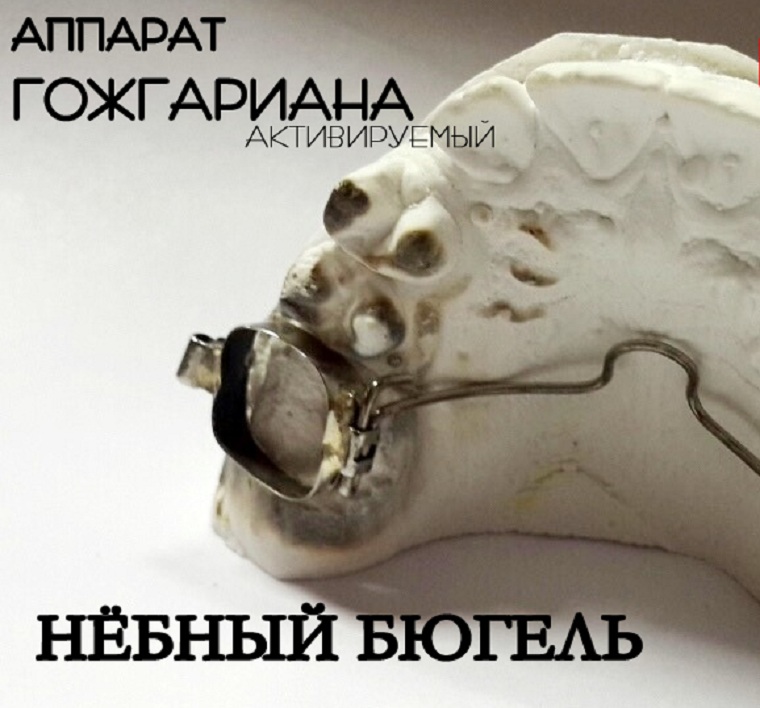 Дуга Гожгариана
