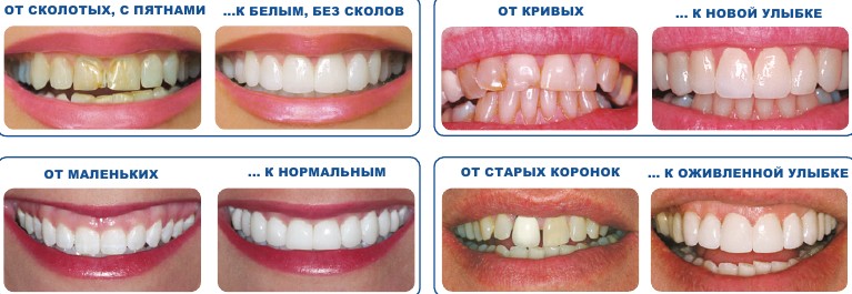 люминиры