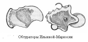 Устройство Ильиной-Маркосян