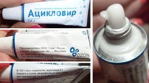 Применение мази для лечения герпеса