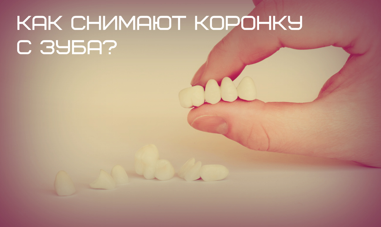 Как снимают коронку?