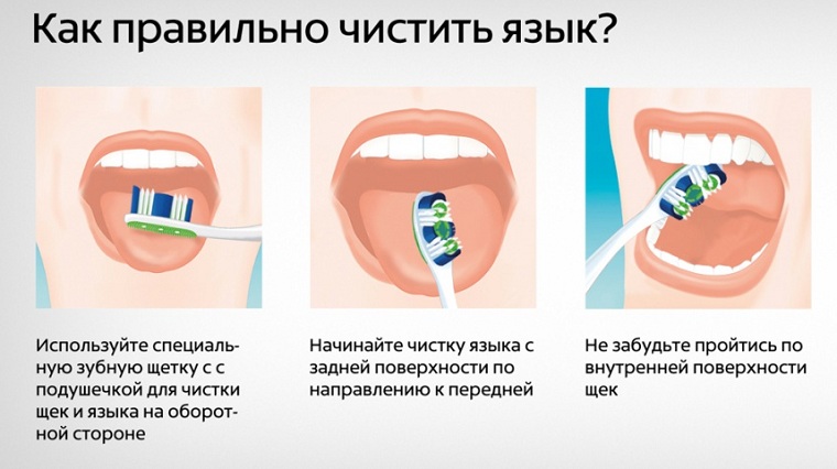 Как правильно почистить язык