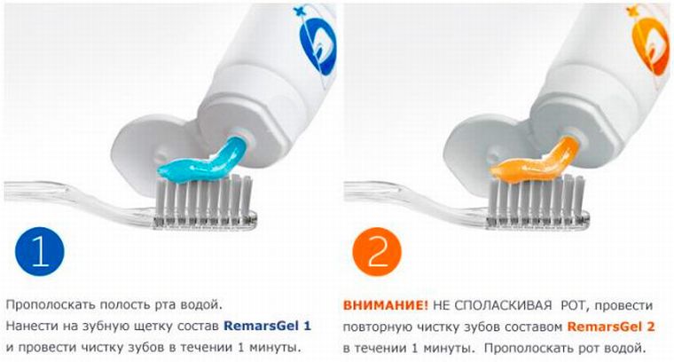 Как использовать Ремарсгель