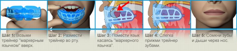 Применение трейнера