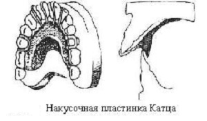 Пластина Катца