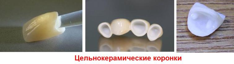 керамические коронки