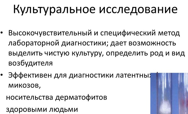 культуральное исследование