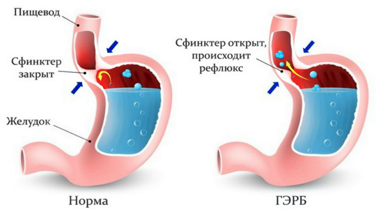 Механизм ГЭРБ