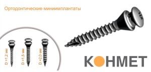 Миниимпланты