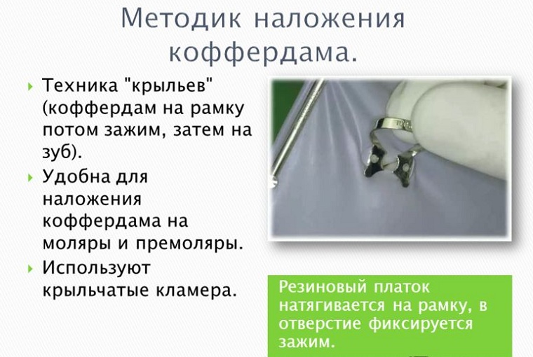 Наложение коффердама