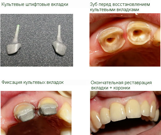 штифт