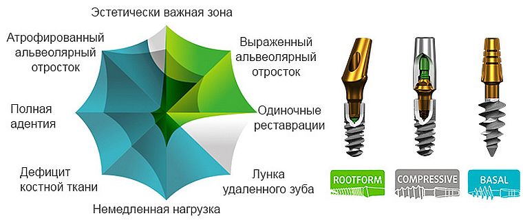 Roott импланты
