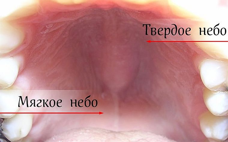 мягкое и твердое нёбо