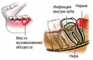 место развития