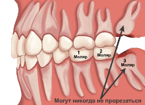 Моляры в челюсти