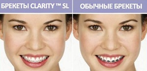 Clarity SL