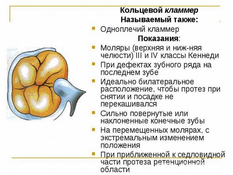 Одноплечий кламмер