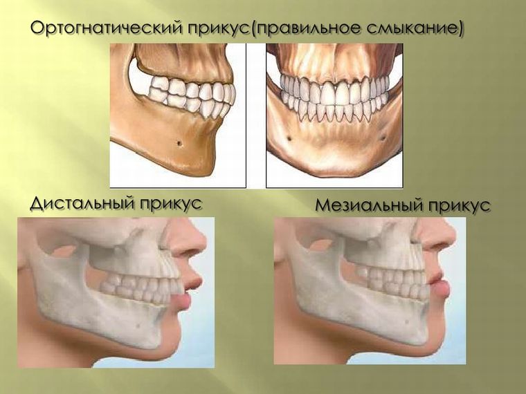 правильный прикус