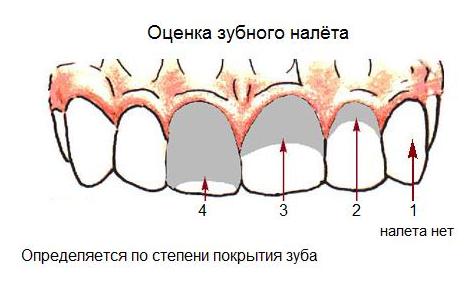 Оценка зубного налета
