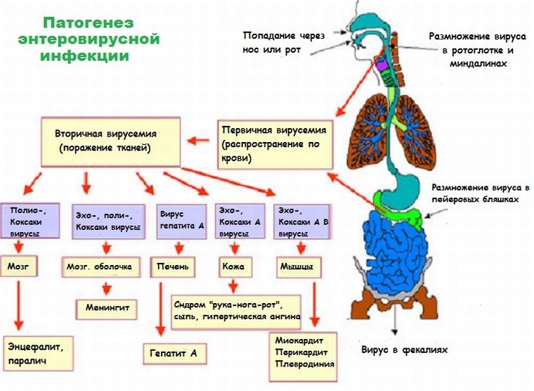 патогенез энтеровирусной инфекции