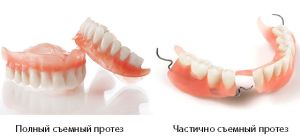 полный и частичный протез