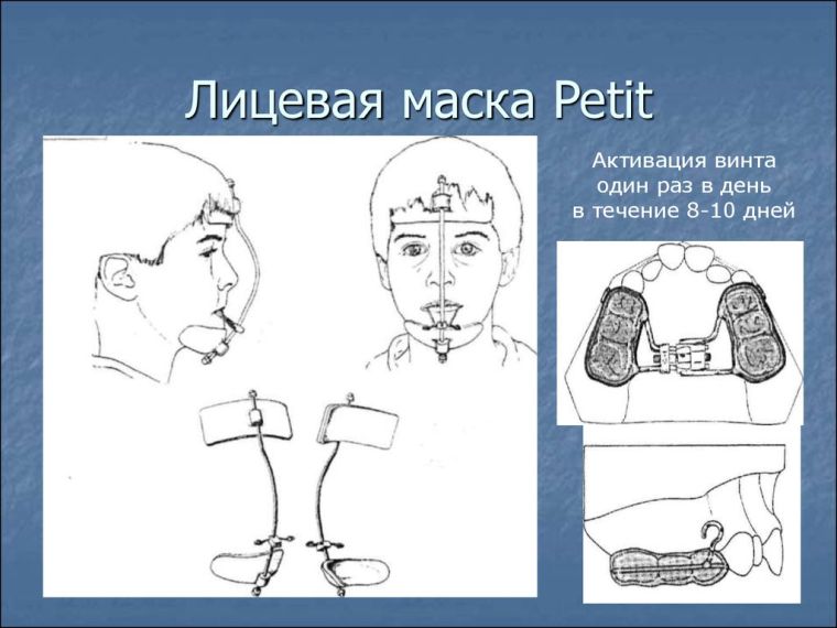Маска Петита