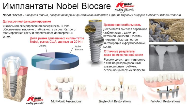 Импланты Нобель