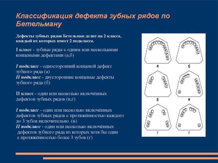 Система Бетельмана