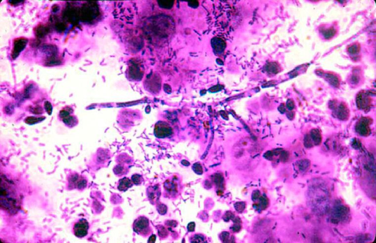Грибы рода Candida