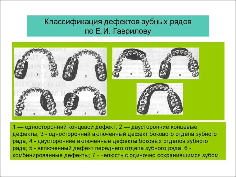 Классификация по Гаврилову