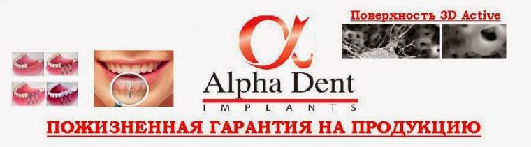 Пожизненная гарантия на импланты