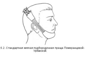 Мягкая праща Померанцевой-Урбанской