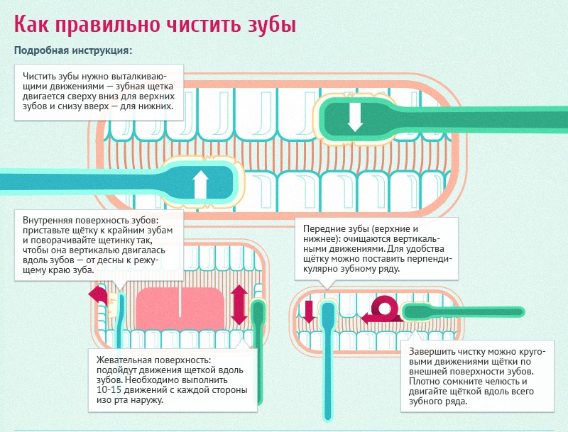 Правильная чистка зубов