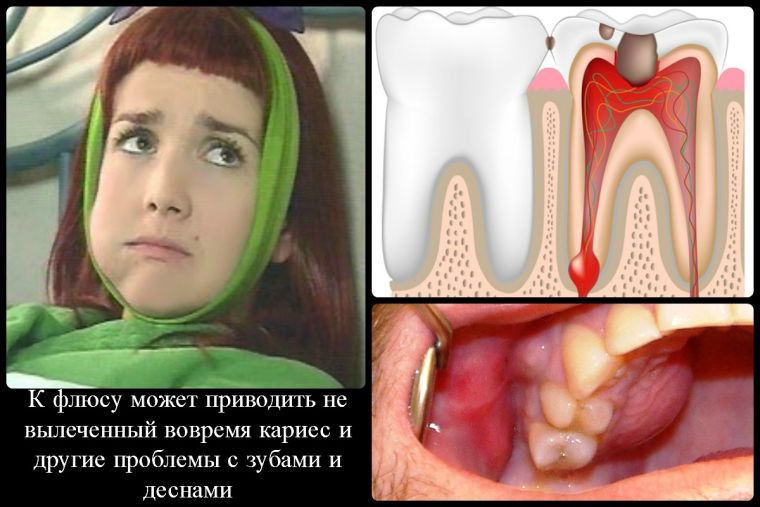 причины флюса